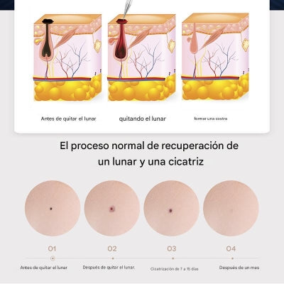 Cauterizador Facial